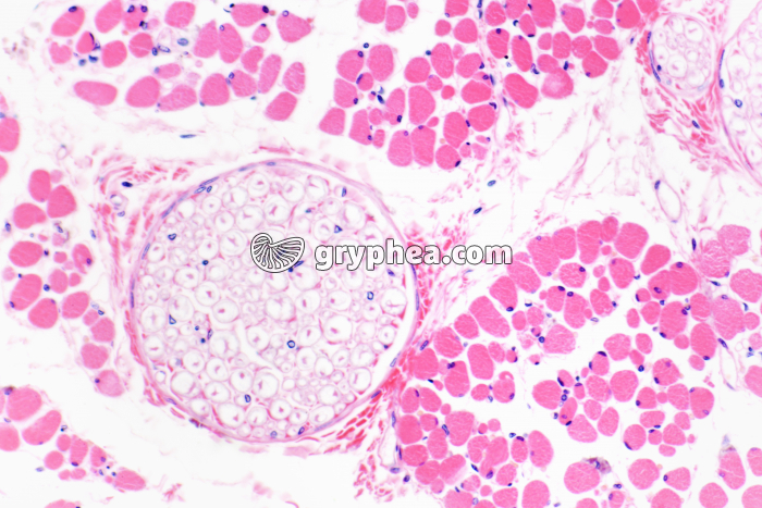 Nerf dans muscle strié CT x100 - gryphea.com